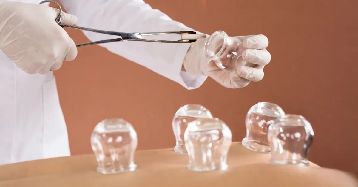 Hijama : précautions, contre-indications et cas particuliers